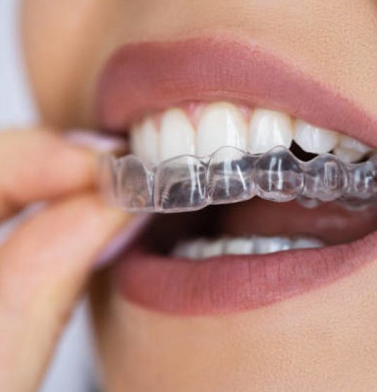 Clear Aligner Dental Night Guard For Teeth